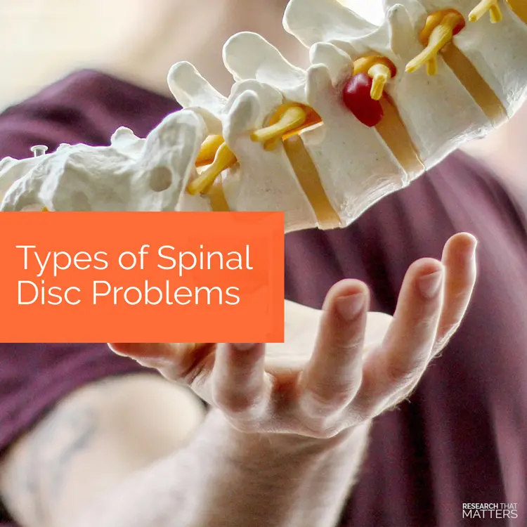 Chiropractic Kissimmee FL Types of Spinal Disc Problems