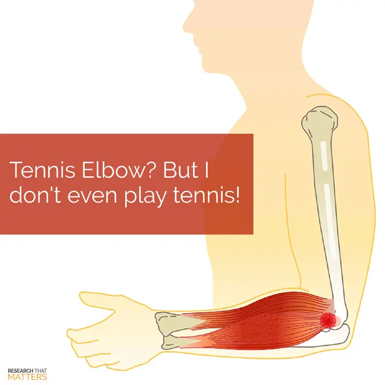 Chiropractic Kissimmee FL Tennis Elbow